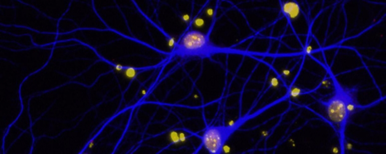 Ova slika prikazuje mišje neurone u petrijevki, iz studije NIH-a koja nije opisana u ovoj priči. Izvor: Lennart Mucke, Sveučilište u Kaliforniji (University of California), San Francisco/Flickr