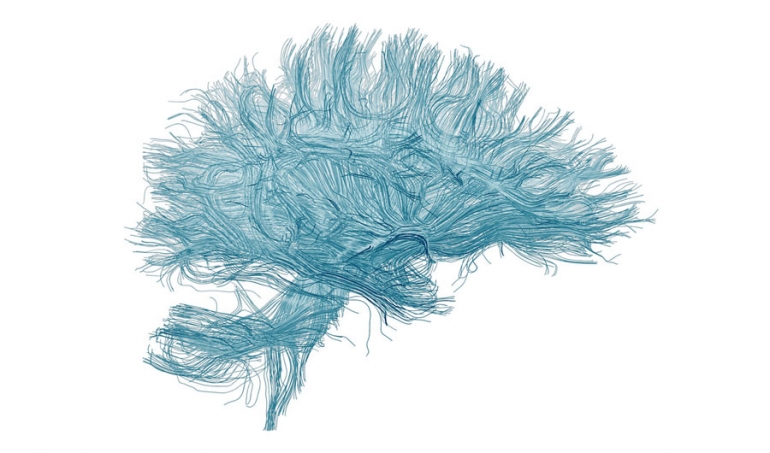 Ilustracija neuronskih sinapsi unutar ljudskog mozga. Izvor: uredio Day Donaldson/Flickr