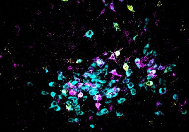 Slika nekih neurona, prikazanih u cijan boji, s oznakama neuronskih veza u magenta i žutoj boji. (Spitzer Lab, UC San Diego)