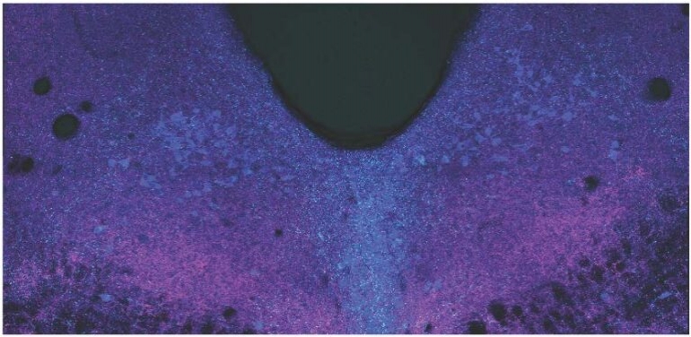 Dorzalno područje mozga, snimljeno konfokalnom mikroskopijom. ( Spitzer Lab, UC San Diego)