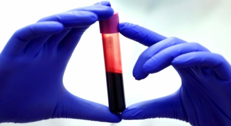 Proteini u krvi mogli bi pomoći u procjeni biološke dobi i rizika od bolesti